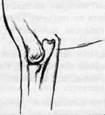 �������, ����� ����������� ��������